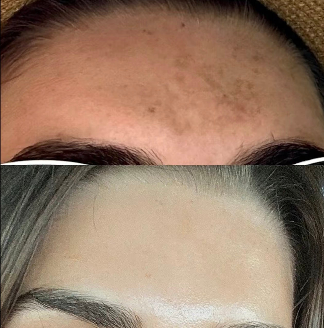 After skincare