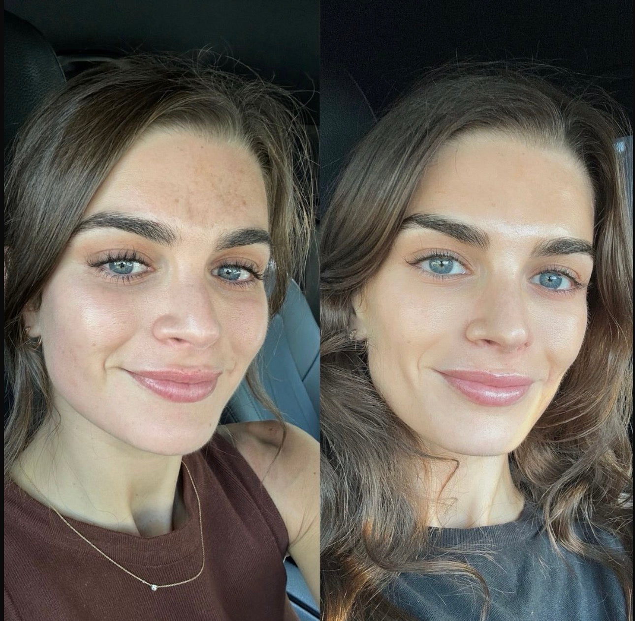 Before skincare